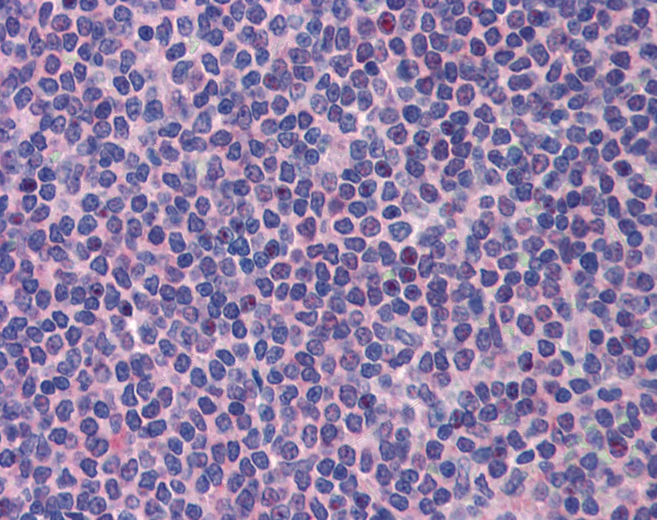 PML Antibody (aa588-637)