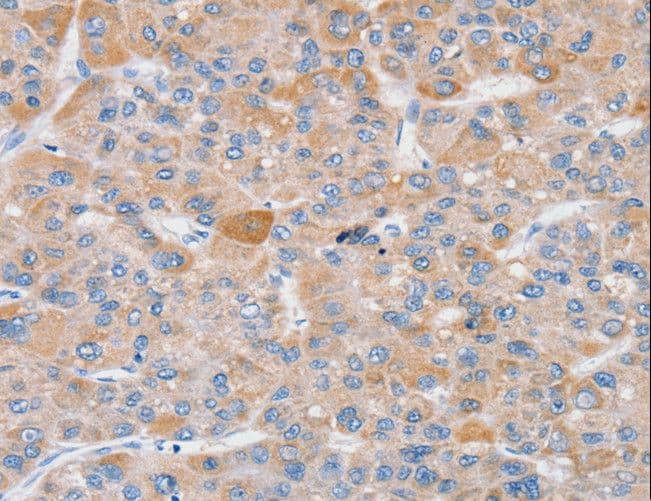 Polyclonal Rabbit anti-Human SLC25A13 / CITRIN Antibody (IHC, WB)
