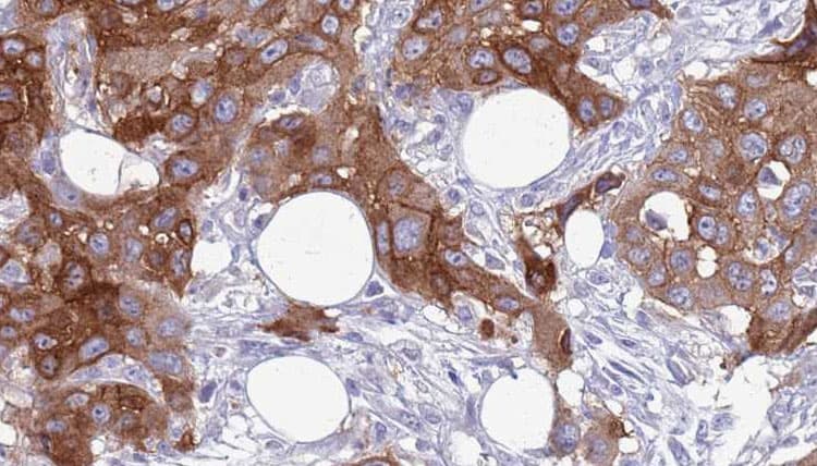 COLEC12 Antibody