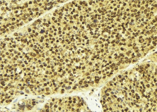 KCNIP3 / Dream / Calsenilin Antibody
