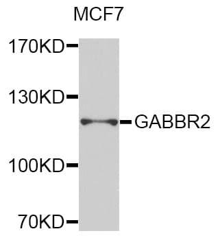 GABBR2 / GABA B Receptor 2 Antibody