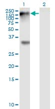 EPHB1 / EPH Receptor B1 Antibody (clone 4G6)