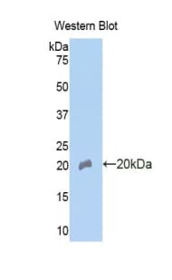 IGFBP3 Antibody (aa151-291)