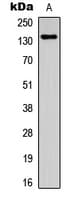 ZMYND8 / RACK7 Antibody (Internal)