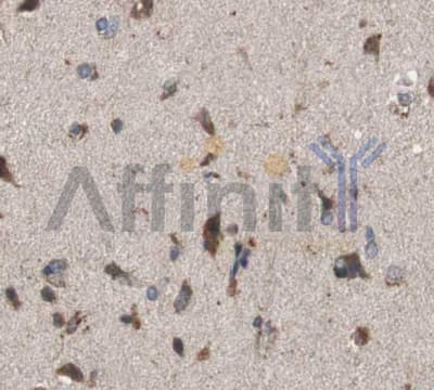 PIK3R1 / p85 Alpha Antibody