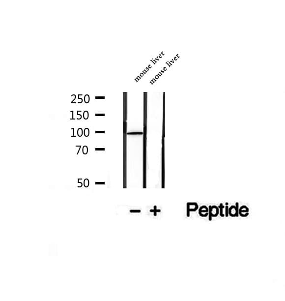 STT3B Antibody