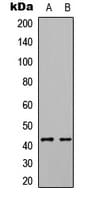 IHC-plus™ EPHX4 / Epoxide Hydrolase 4 Antibody (Internal)