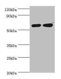 Polyclonal Rabbit anti-Human P4HA2 Antibody (aa236-535, IHC, WB)