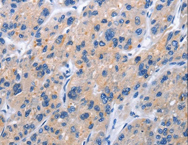 TNFRSF9 / 4-1BB / CD137 Antibody
