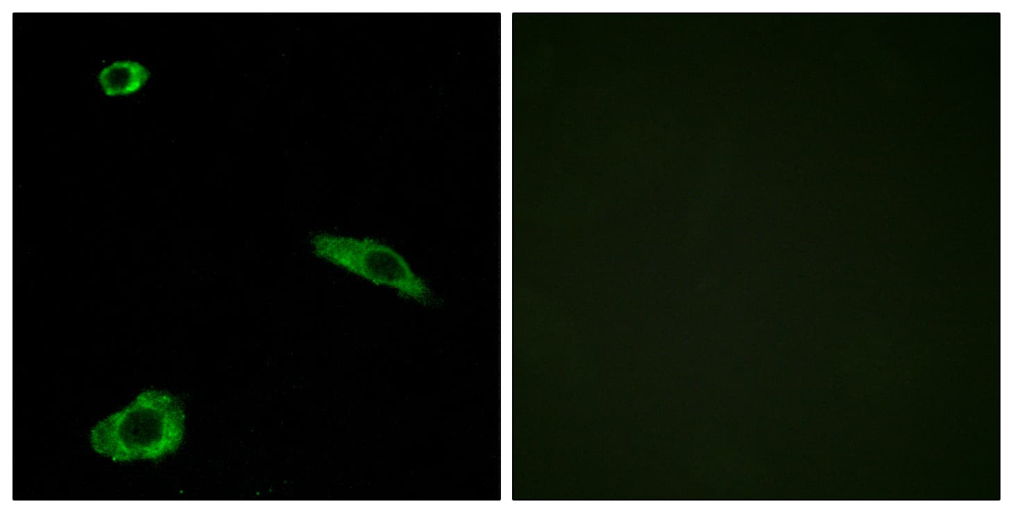 MC2R / ACTHR / ACTH Receptor Antibody (aa248-297)