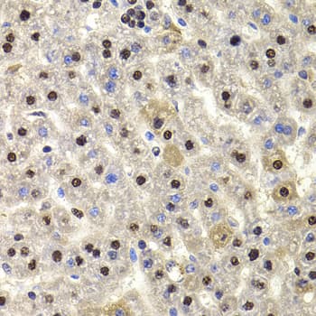 Polyclonal Rabbit anti-Human HIRIP3 Antibody (IHC, IF, WB)