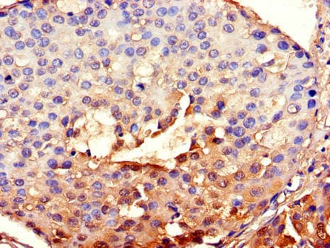 Polyclonal Rabbit anti-Human BHLHB2 / DEC1 Antibody (IHC, IF)