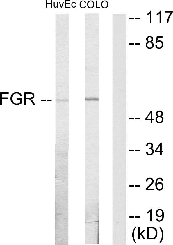FGR Antibody (aa61-110)