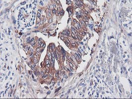 PFKP Antibody (clone OTI2E10)