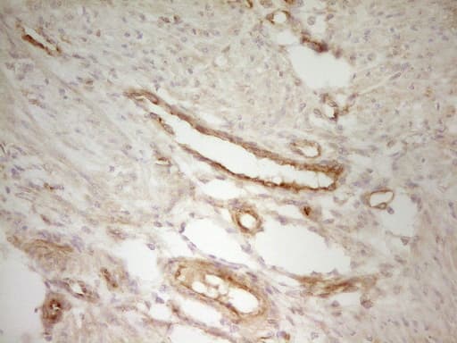 Monoclonal Mouse anti-Human PAK4 Antibody (clone OTI1C7, aa1-308, IHC, WB)