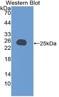 VCL / Vinculin Antibody (aa879-1064, APC)