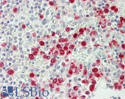 IHC-plus™ Polyclonal Rabbit anti-Human RNASE3 Antibody (aa102-151, IHC, WB)