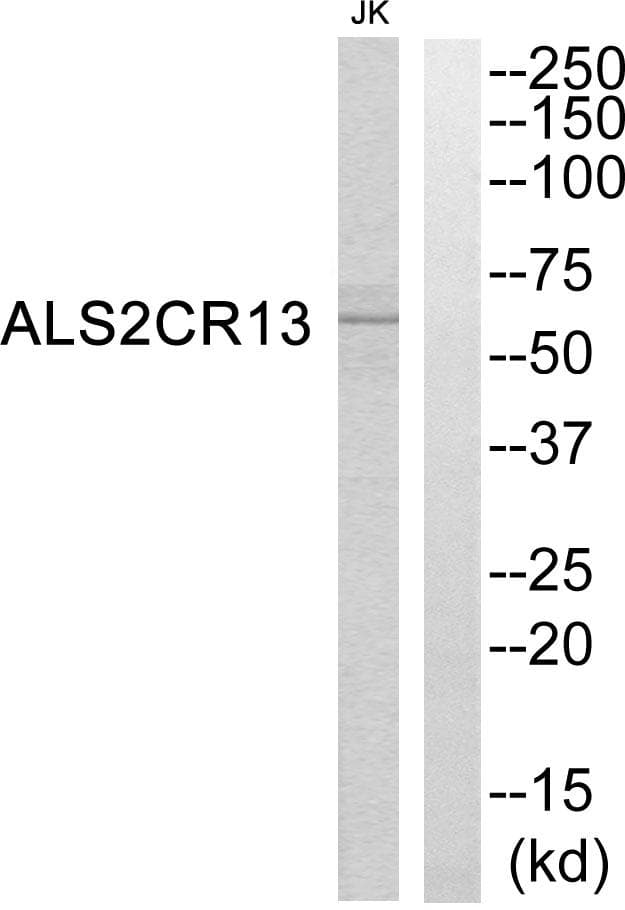 FAM117B / ALS2CR13 Antibody
