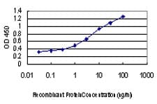 DAPK1 / DAP Kinase Antibody (clone 2E7)