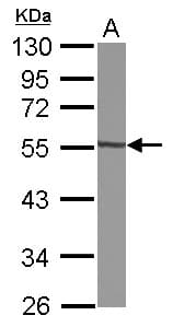 Polyclonal Rabbit anti-Human GTDC1 Antibody (IHC, WB)