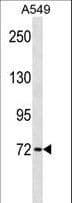 Polyclonal Rabbit anti-Human KBTBD7 Antibody (aa428-455, WB)