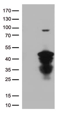 CTSL / Cathepsin L Antibody (aa114-333, clone OTI5A5)