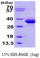 Human PMM1 Protein (Recombinant His)