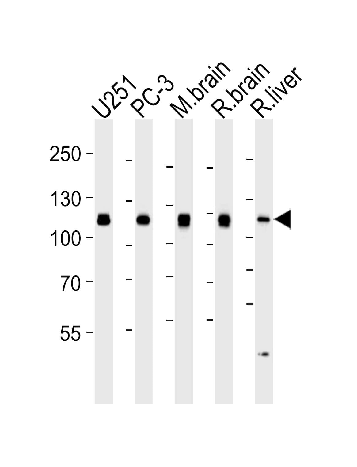 USP5 Antibody (clone 1340CT704.170.140)