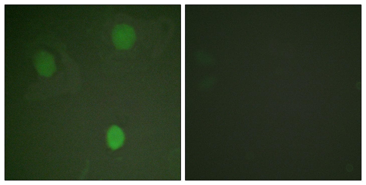 Polyclonal Rabbit anti-Human MYC / c-Myc Antibody (p62, IHC, IF, WB)