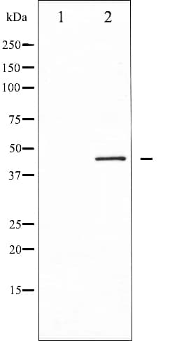 CALR / Calreticulin Antibody