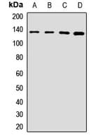 CC2D1A Antibody