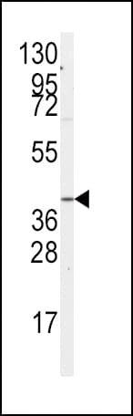 IHC-plus™ Polyclonal Rabbit anti-Human GNA12 Antibody (Ser67, IHC, WB)