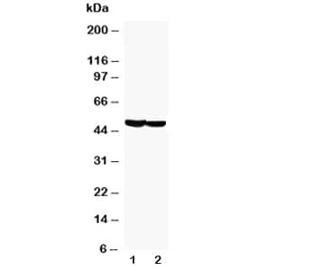 GFAP Antibody (aa417-432)