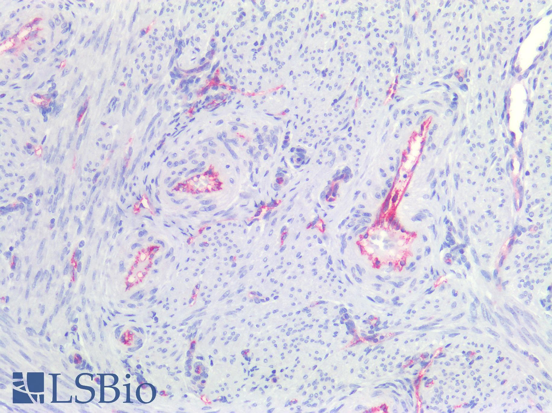 PathPlus™ CLDN5 / Claudin 5 Antibody (aa169-218)