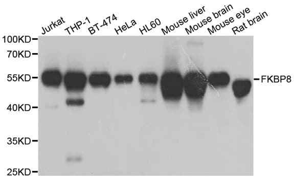 IHC-plus™ FKBP38 / FKBP8 Antibody (aa60-270)