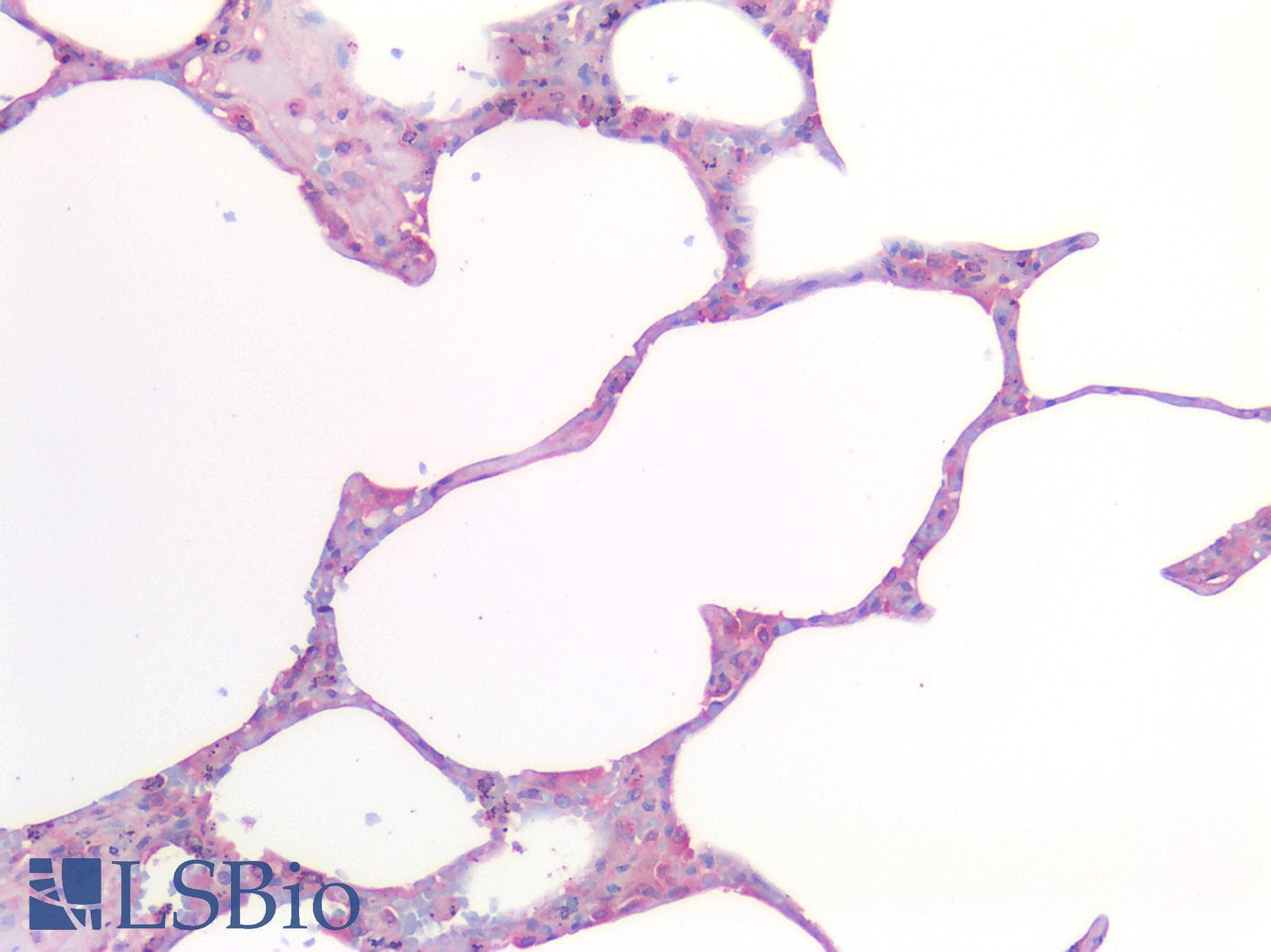 IHC-plus™ Polyclonal Rabbit anti-Human MMP2 Antibody (IHC)