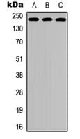 Polyclonal Rabbit anti-Human KDR / VEGFR2 / FLK1 Antibody (Internal, IHC, IF, WB)