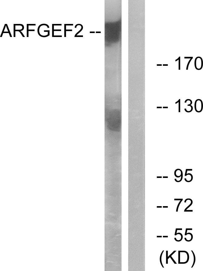 ARFGEF2 / BIG2 Antibody