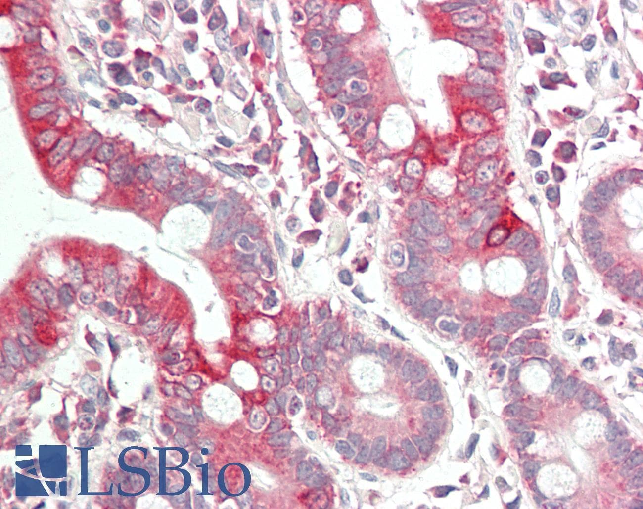 PathPlus™ Polyclonal Goat anti-Human VEGFA / VEGF Antibody (aa250-300, IHC, WB)