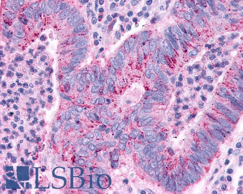 PathPlus™ Polyclonal Rabbit anti-Human GPBAR1 / TGR5 Antibody (C-Terminus, IHC)