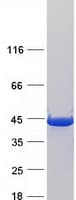 Human UROD Protein (Recombinant Myc-DDK (Flag))