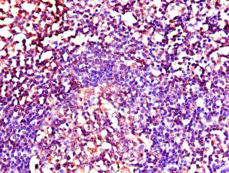 NRG1 / Heregulin / Neuregulin Antibody