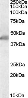 PathPlus™ ACTA2 / Smooth Muscle Actin Antibody (aa1-50)