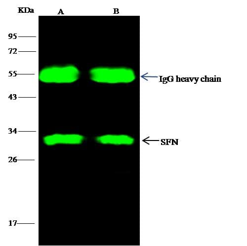 Polyclonal Rabbit anti-Human SFN / Stratifin / 14-3-3 Sigma Antibody (Preservative Free, IF, WB)