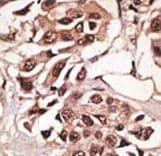 ALK3 / BMPR1A Antibody (aa21-51)