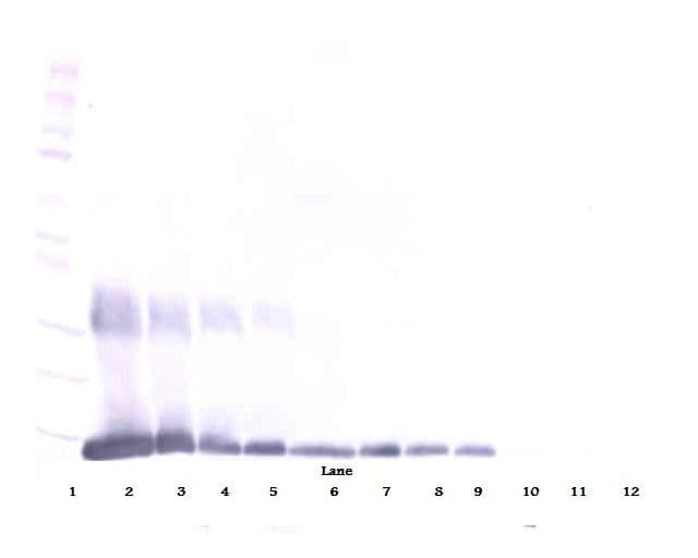 IHC-plus™ Polyclonal Rabbit anti-Human LGALS1 / Galectin 1 Antibody (IHC, WB)