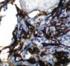 NGFR / CD271 / TNR16 Antibody (Ready-to-Use)