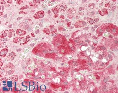 IHC-plus™ ARL6 Antibody