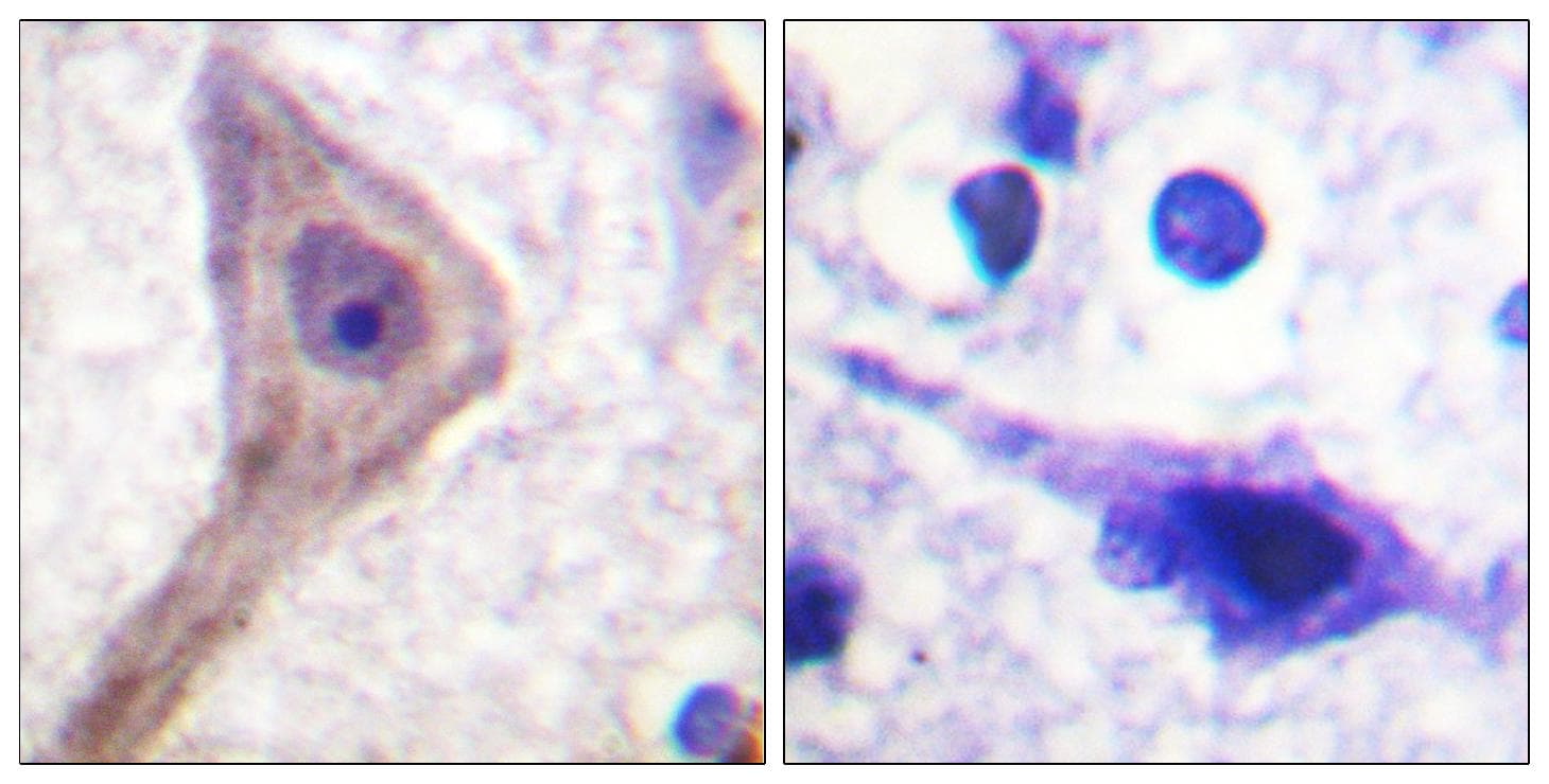 AKT1S1 / PRAS40 Antibody (p246)