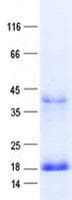 Human PSMG4 Protein (Recombinant His, N-Terminal)